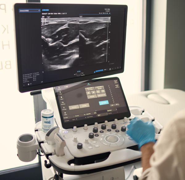 Profesjonalny aparat USG wysokiej rozdzielczości w gabinecie Synovia Warszawa - sprzęt do diagnostyki ortopedycznej